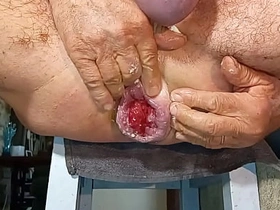 Gapingman 2025-14 gay sex videos real asian