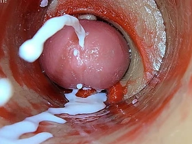 Camera Medial Deep Pussy Captures Dose Ejaculation of Sperm ASMR asian gay boys sex xxx videos