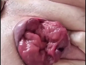 Prolapse show joyful sex videos asian china