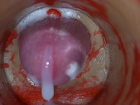 Insemination - Internal Camera Captures Deep Male Ejaculation asian gay abusive sex videos