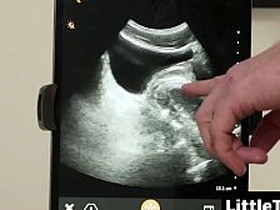 I wanted to watch my dick breed him with the ultrasound despite that - Littletwink sex videos of asian delighted boys