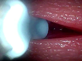 I couldn’t believe what happens INSIDE the penis as sperm passes through (endoscopic footage) asian gay sex hindi videos