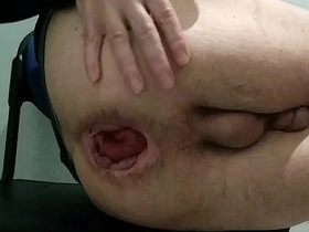 Showing my ass after 300 anal videos together with a uncompromisingly hard anal insertion flimsy asian detached sex videos